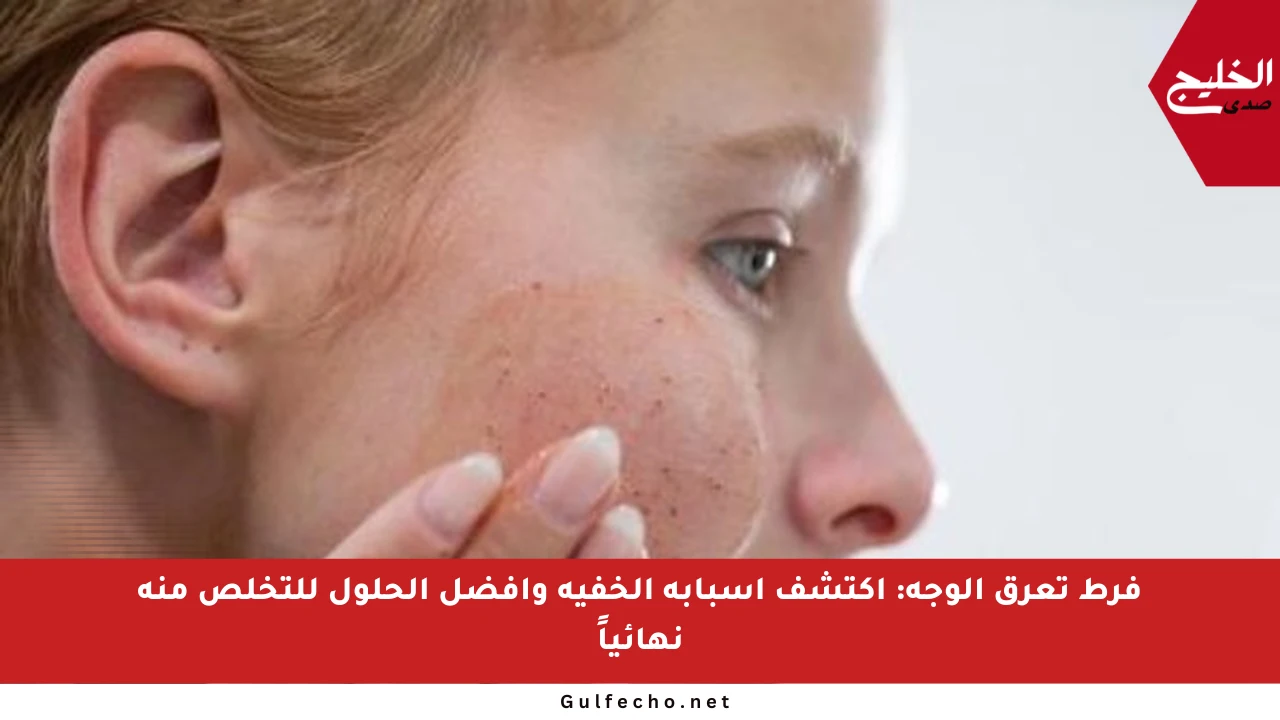 فرط تعرق الوجه: اكتشف أسبابه الخفية وأفضل الحلول للتخلص منه نهائياً
